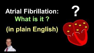 Atrial Fibrillation: What is it? - Plain English, no Doctor language!