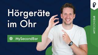 Hörgeräte im Ohr 2024: Mini Hörgeräte Preise, Erfahrungen & mehr