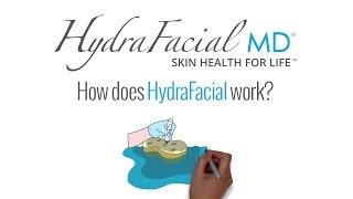 How Does HydraFacial Work? Our Animated Guide!