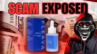 Exposing A Hair Loss SCAM