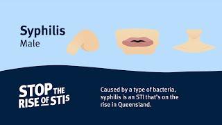 Sexual Health - Syphilis (Male)