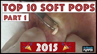 My Top 10 BEST Blackhead Pops of 2015: Part 1, #4-#10