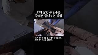 9년 앓은 우울증 극복한 방법 / 집단상담의 효과