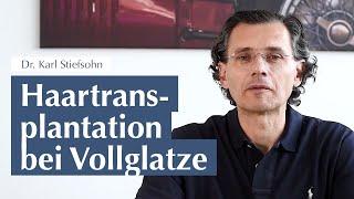 Haartransplantation bei Vollglatze