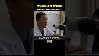 女孩眼球真實驚現異物！醫生開刀移除…結果讓我更崩潰…… #未解之谜 #考古 #历史 #奇闻 #探秘