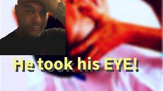 Eye gouged out by inmate!! What I saw…