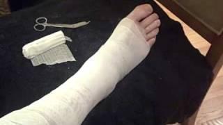 Wound Care Certification: Unnas Boot Application Demo