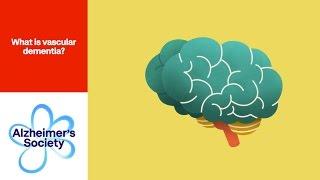 What is vascular dementia?