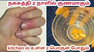 Red big finger / how to cure paronychia at home treatment / naga suthi remedy /நகசுத்தி சரியாக