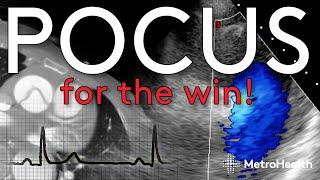 POCUS for the Win: Cracking the Mysterious Case of Chest Pain