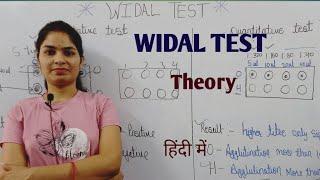 Widal Test | Widal Test For Typhoid | Typhoid test in hindi | Typhoid disease test | विडाल टेस्ट