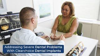 ClearChoice Dental Implants: A Life-Changing Fix for Severe Tooth Loss 