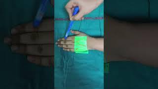 Vein finder in difficult IV cannulation #anaesthesia #ottechnician #viralvideo #trendingshorts #fyp