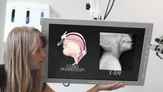 Foreign Bodies in the Throat - ENT Basics