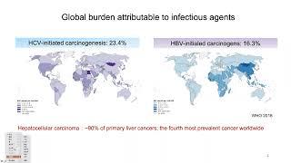 HBV initialed carcinogenesis and immune microenvironment