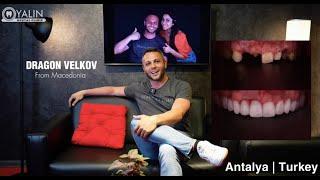 Dental Care in Turkey Antalya | YALIN Dental Clinic #teethturkey #turkeyteeth  #dentiststurkey