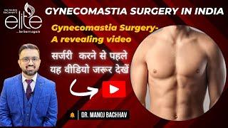 Gynecomastia Surgery in India | Affordable Cost & Expert Care by Dr. Manoj Bachhav