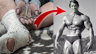 life story of Arnold | by Manish Jodhpuri | amazing facts | #shorts