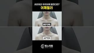 아이돌같은 여리여리 #직각어깨 원한다면? #어깨필러️
