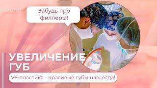 УВЕЛИЧЕНИЕ ГУБ БЕЗ ФИЛЛЕРОВ И НАВСЕГДА / #левицкая #абриелль