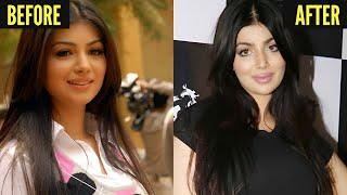 20 Bollywood Famous Celebrity Plastic Surgery Disasters