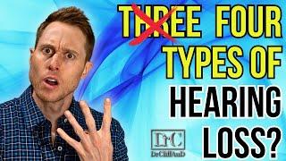 3 Types of Hearing Loss EXPLAINED | Plus a NEW 4th Type!