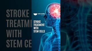 Stem Cells for Stroke Recovery #stemcell #stroke #shorts