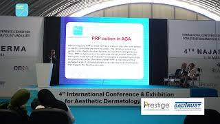 PRP is one of few interventions for androgenetic alopecia | Najaf Derma 2023