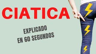 CIATICA (Explicado en 60 Segundos)