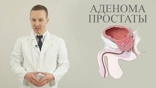 аденома простаты (ДГПЖ)