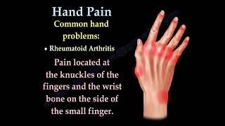 Hand and Finger Pain: Common Causes and Symptoms Explained