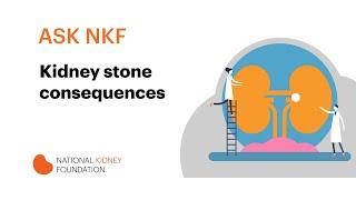 Kidney stone consequences | National Kidney Foundation
