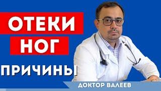 Отеки ног. Почему отекают ноги? Основные причины возникновения отеков на ногах.