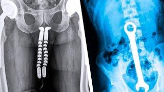 20 Strangest Things Discovered by X-Rays