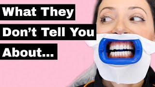 Teeth Whitening SIDE EFFECTS