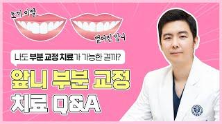 [구로교정치과] 저도 앞니 교정이 가능한 건가요? [앞니부분교정Q&A]