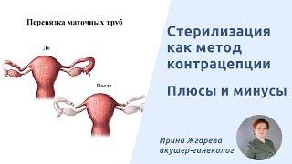 Стерилизация женщин. Плюсы и минусы стерилизации