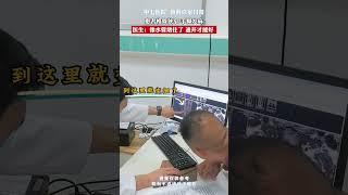 椎管狭窄，手脚发麻 #椎管狭窄 #骨科 #医学科普