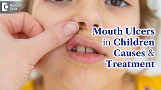 Mouth Ulcers in Children | MOUTH ULCER Treatment & Causes - Dr. K Saranya | Doctors' Circle