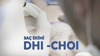 DHI -CHOI Saç Ekimi / 2019