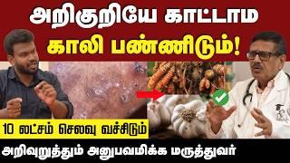 Fatty Liver : கல்லீரல் பற்றி யாருக்கும் தெரியாத அதிர்ச்சி தகவல்ககள் | Liver | Positivitea