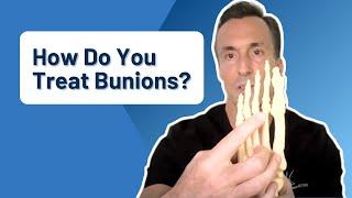 How Do You Treat Bunions?