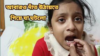 আবারও দাঁত উঠায়তে গিয়ে যা ঘটলো ।What happened while picking up teeth again.