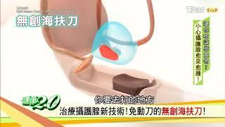 搶救攝護腺肥大！醫師推薦免動刀「無創海扶刀」治療新技術！健康2.0