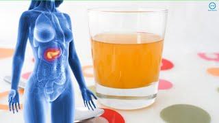 Signs Your Pancreas Is In Trouble and How to Heal It Naturally