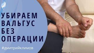 ЛЕЧЕНИЕ ВАЛЬГУСА. Как убрать «косточку» на ноге без операции. Простые упражнения при вальгусе стопы