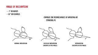 Femur clinical anatomy - fractures, angle of inclination and declination and blood supply