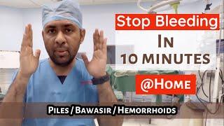 STOP PILES bleeding in 10 minutes ? Quick Cure HEMORRHOIDS BAWASIR in 2 days