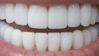 How To Have Natural White Teeth in 3 minutes ( Works 100% )