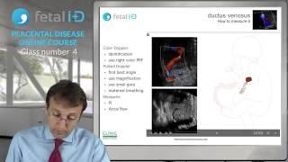 Лекция 4 Placental Disease Русский, Эдуард Гратакос, компания Альфамед.